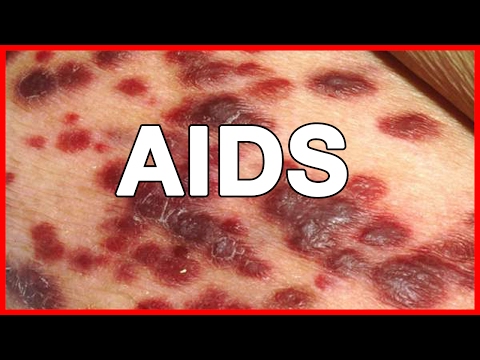 علاج مرض الايدز