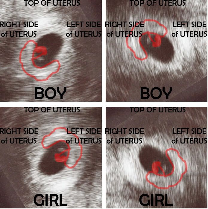 طريقة تحديد جنس الجنين ولد أم بنت