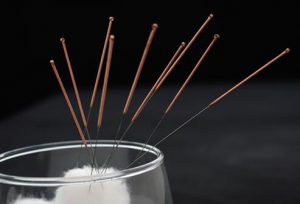 acupuncture-s3-photo-of-acupuncture-needles-and-cotton-swab-1