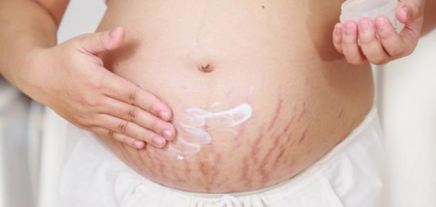 وسائل القضاء على ترهلات البطن بعد الولادة